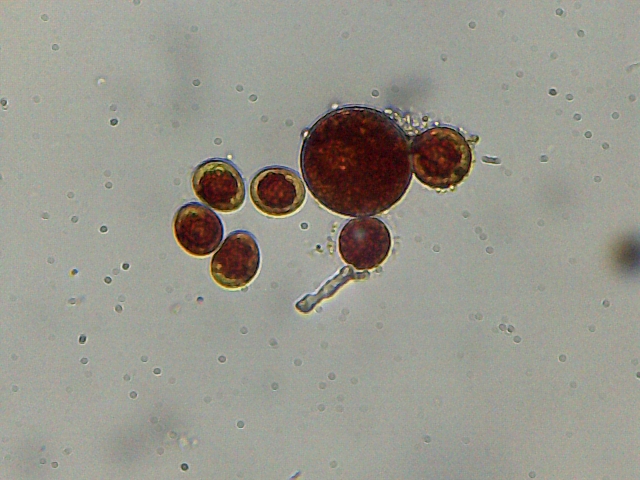 Haematococcus pluvialis e philodina